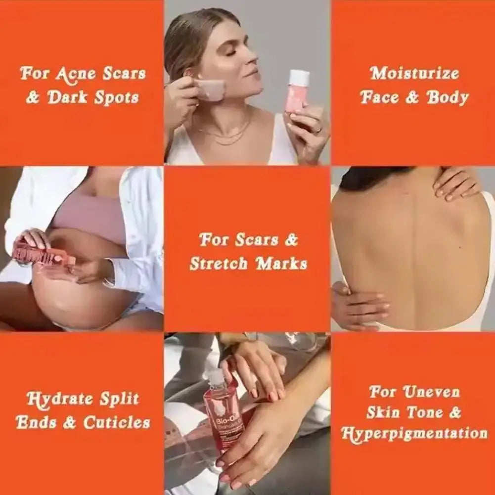 Bio-Oil Body Skin Care Essential Oil Fades Stretch Marks Fades Facial Fine Tattoos Body Skin Oil Improves Uneven Skin care