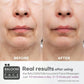 Microcurrent Facial Massager, Facial Roller - Skin Tightening Care For Women And Men - Face Wrinkle Removal, Anti Aging