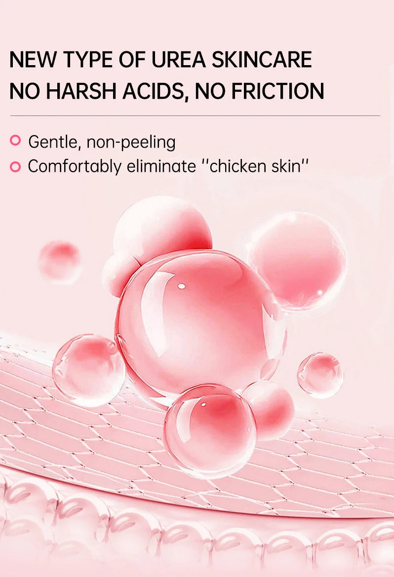 JoyPretty Chicken Remover Skin Care Body Cream Keratosis Pilaris Treatment Skin Repair Body Lotion Moisturizing Whiten Body Care